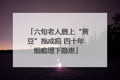 六旬老人唇上“黄豆”拖成癌 四十年烟瘾埋下隐患